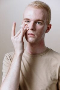 Hydrated skin problems