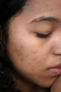,Drinking Water For Your Skin
