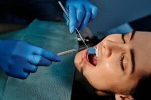 Treatment of Tooth Extraction